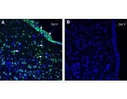 Anti-SLC38A2 (SNAT2) Antibody