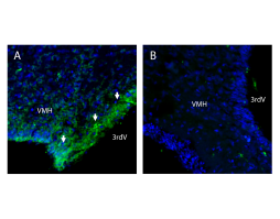 Anti-CAT-1 (SLC7A1) (extracellular) Antibody