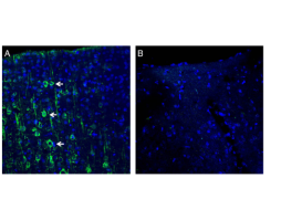 Anti-MAGT1 (extracellular) Antibody