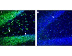 Anti-SLC11A1/NRAMP1 (extracellular) Antibody