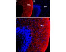 Anti-NKCC1 (SLC12A2) Antibody