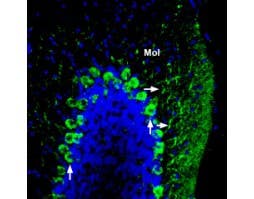 Anti-ADAM22 (extracellular) Antibody