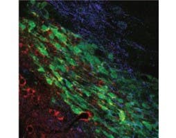 Mouse Anti-KCNN4 (K<sub>Ca</sub>3.1, SK4) (extracellular) Antibody