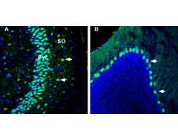 Anti-Kidins220 Antibody