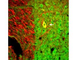 Anti-Neurotrophin 3 (NT-3) Antibody