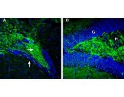 Anti-Synapsin II (SYN2) Antibody