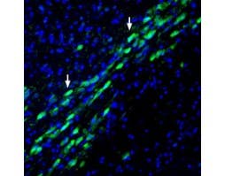Anti-Na<sup>+</sup>/H<sup>+</sup> Exchanger 1 (NHE-1) (extracellular) Antibody