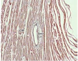 Anti-NCX1 (SLC8A1) Antibody