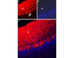 Anti-NCX2 (SLC8A2) Antibody