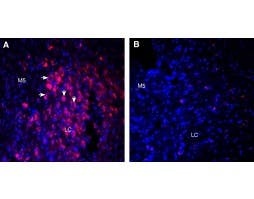 Guinea Pig Anti-Orexin Receptor 1 Antibody