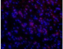 Anti-Orexin Receptor 1 Antibody