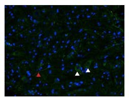 Anti-µ-Opioid Receptor (OPRM1) (extracellular) Antibody