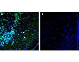 Anti-κ-Opioid Receptor (OPRK1) (extracellular) Antibody