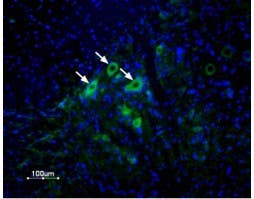 Anti-δ-Opioid Receptor (OPRD1) (extracellular) Antibody
