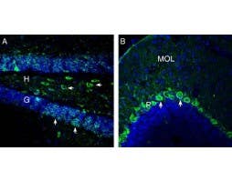 Anti-OXGR1/GPR99 Antibody