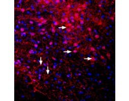 Anti-GIRK2 (K<sub>ir</sub>3.2) Antibody