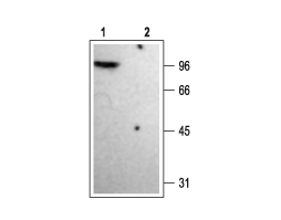 Anti-K<sub>V</sub>1.4 Antibody