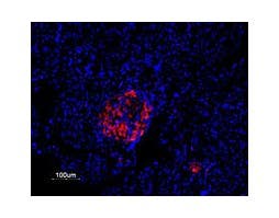 Anti-K<sub>V</sub>2.1 Antibody