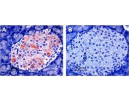 Anti-K<sub>ir</sub>6.2 Antibody