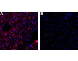 Anti-KCNN3 (K<sub>Ca</sub>2.3, SK3) (N-term)-ATTO Fluor-594 Antibody