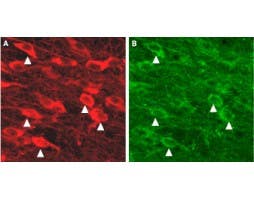Anti-KCNN3 (K<sub>Ca</sub>2.3, SK3) (N-term) Antibody
