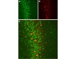 Anti-<em>slo</em>β2 (KCNMB2) Antibody