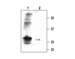 Anti-<em>slo</em>β1 (KCNMB1) Antibody