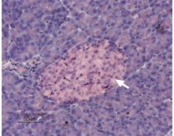 Anti-KCNK5 (TASK-2) Antibody