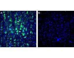 Anti-KCNN1 (K<sub>Ca</sub>2.1, SK1) Antibody