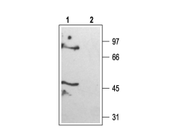 Anti-KCNK6 (TWIK-2) Antibody