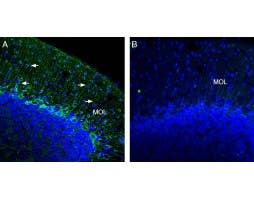 Anti-K<sub>ir</sub>2.2 (KCNJ12) Antibody