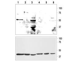 Anti-KCNK9 (TASK-3) (extracellular) Antibody