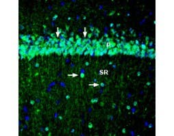 Anti-KCNQ3 Antibody