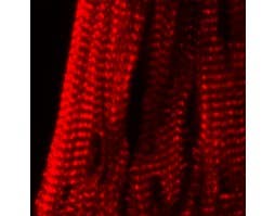 Anti-KCNE2 (MiRP1) Antibody
