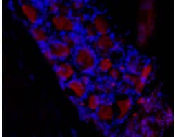 Anti-HCN3 Antibody