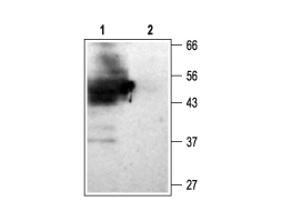 Anti-KCNJ15 (K<sub>ir</sub>4.2) Antibody