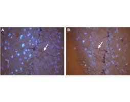Anti-CNGA3 Antibody