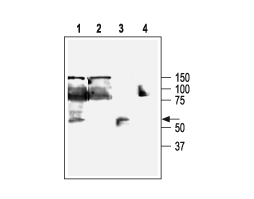Anti-KCNN4 (K<sub>Ca</sub>3.1, SK4) Antibody