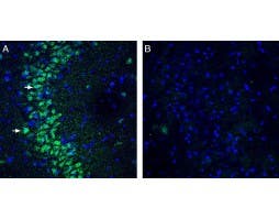 Anti-<em>slo</em>β3 (KCNMB3) (extracellular) Antibody