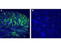 Anti-TMEM150C/Tentonin 3 (extracellular) Antibody