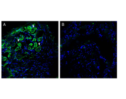 Anti-Piezo2 Antibody