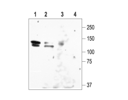 Anti-KCNH1 (EAG-1) Antibody
