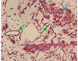 Anti-K<sub>ir</sub>6.1 (KCNJ8) Antibody