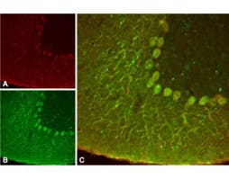 Anti-KCNK4 (TRAAK) Antibody