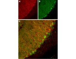 Anti-KCNK1 (TWIK-1) (extracellular) Antibody