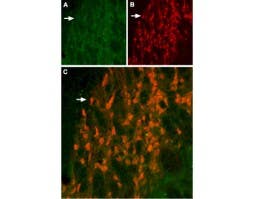 Anti-KCNH6 (erg2) Antibody