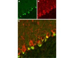 Anti-K<sub>V</sub>β2 Antibody