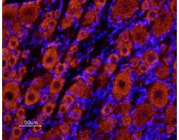 Anti-KCNK18 (TRESK) (extracellular) Antibody
