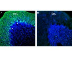 Anti-KCNT1 (Slack) Antibody
