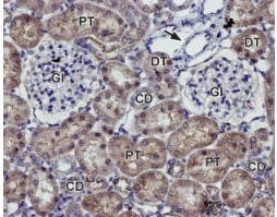 Anti-K<sub>ir</sub>7.1 (extracellular) Antibody